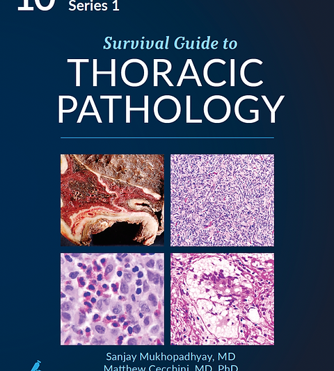 Survival Guide to Thoracic Pathology | Innovative Science Press