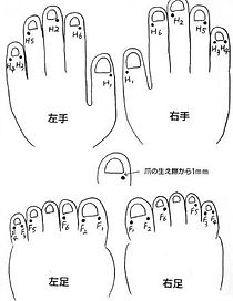 井穴刺絡.COM | ホーム