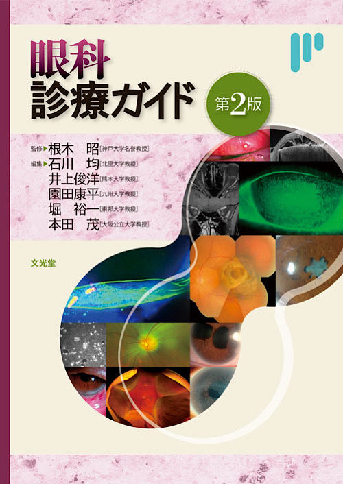 眼科診療ガイド 第2版』の執筆に参加させていただきました