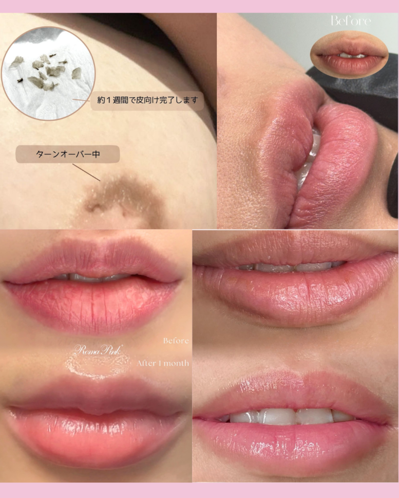 Roma Pink ローマピンク | 福山市の健康と美を考えるエステサロン