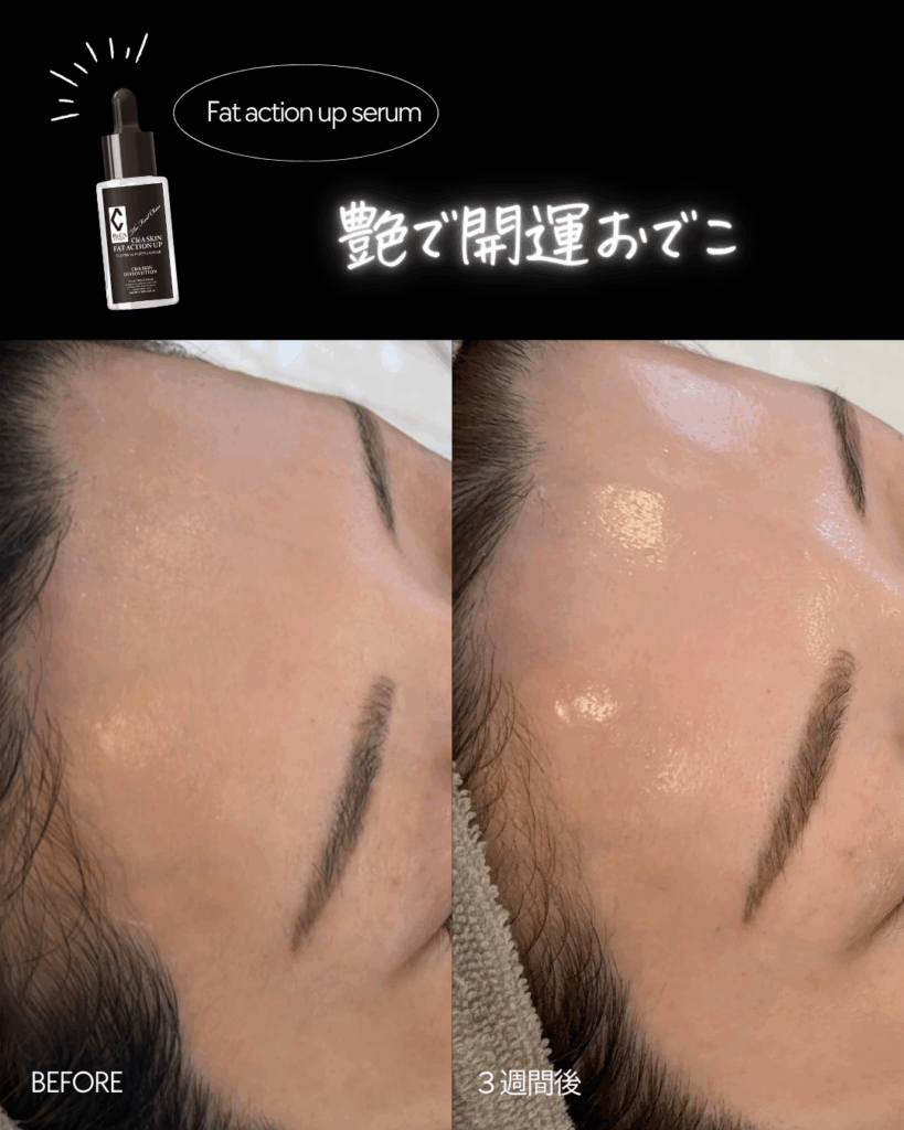 ふっくらハリ肌へ！クレアスキン ファットアクションアップ美容液