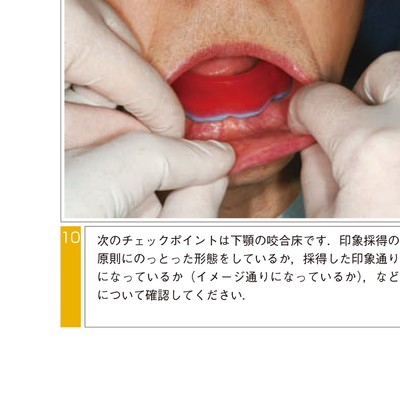 図解・咬合採得 図解・咬合採得 7 咬合採得①／垂直的顎
