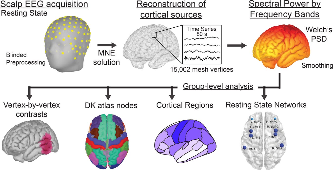 健康・医学 Brain Source Localization Using EEG Brain Source