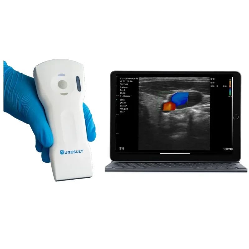 獣医ポータブル超音波を購入 - Suresult